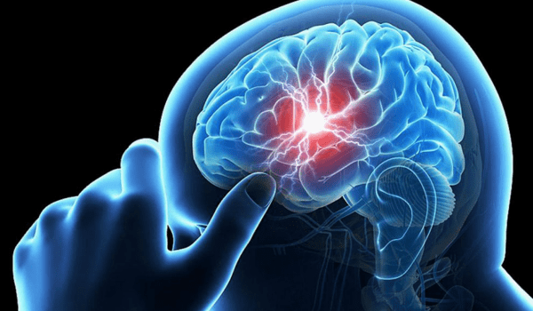 Photo of أعراض التهاب الأعصاب في الرأس