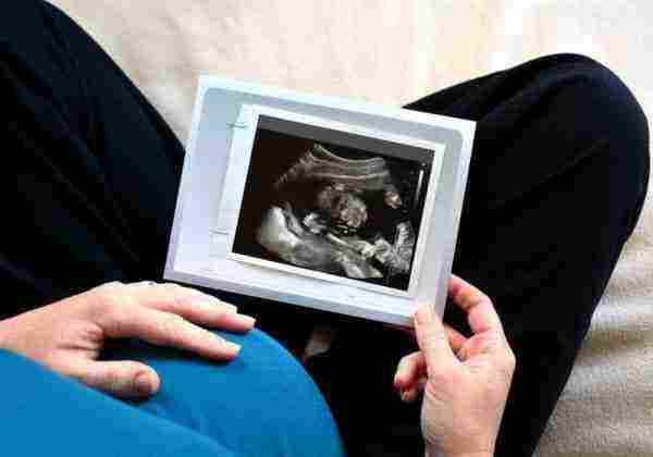 Photo of علاج الغازات عند الحامل في الأشهر الأولى