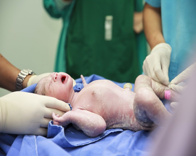 Photo of انتفاخ كيس الصفن عند حديثي الولادة