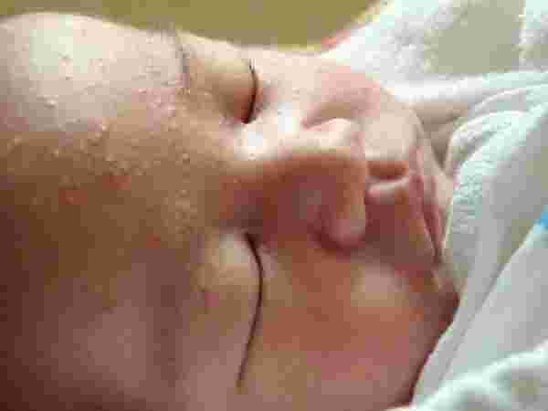 Photo of حساسية الجلد عند الأطفال حديثي الولادة