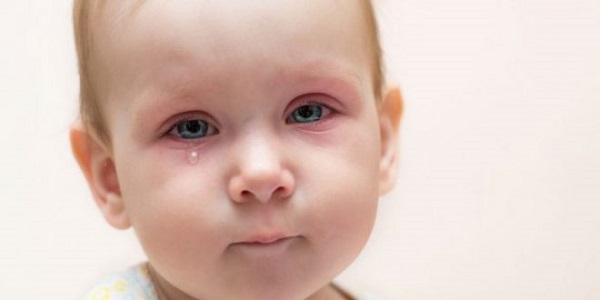 Photo of علاج حساسية العين عند الأطفال