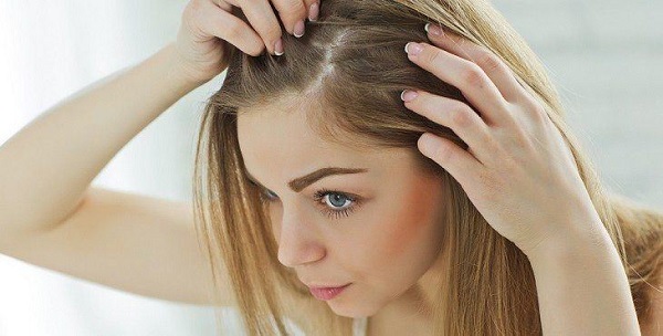 Photo of ما هو أفضل علاج لقشرة الشعر.. و5 وصفات طبيعية لعلاجه