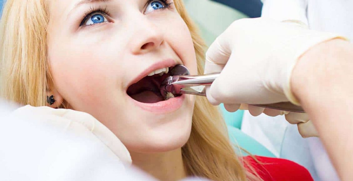 Photo of هل خلع الضرس يؤثر على باقي الأسنان