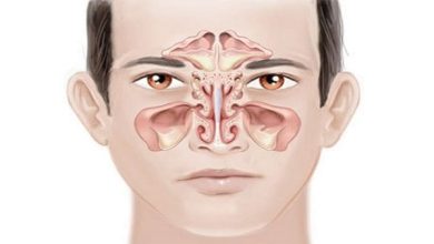 أفضل طرق علاج للجيوب الأنفية والصداع