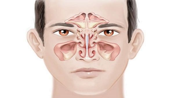 أفضل طرق علاج للجيوب الأنفية والصداع