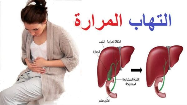 الأطعمة والمشروبات الممنوعة لمرضى المرارة