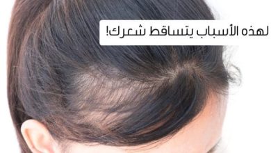 علاج تساقط الشعر عند النساء مضمون 100%