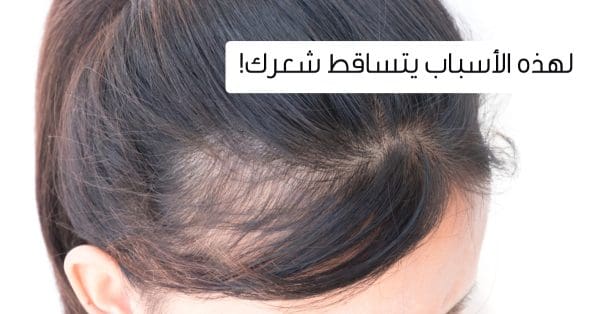 علاج تساقط الشعر عند النساء مضمون 100%