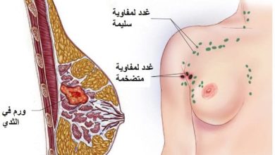 ما هي مواصفات الكتلة السرطانية في الثدي؟