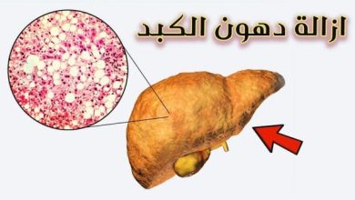 أسهل طريقة لإزالة دهون الكبد