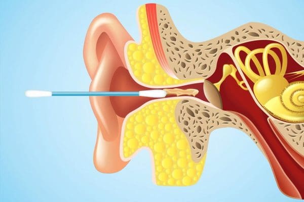 أفضل الطرق لعلاج انسداد الأذن في المنزل