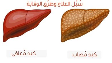 أفضل علاج للتخلص من دهون الكبد