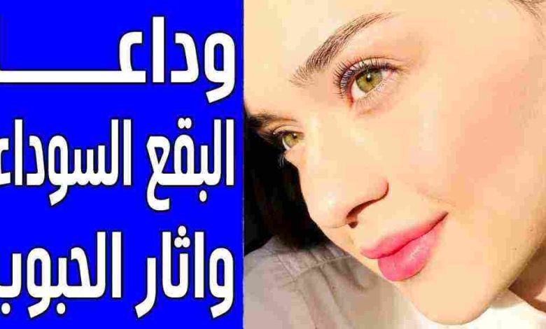 ازالة اثار حب الشباب والبقع الغامقه ببساطه