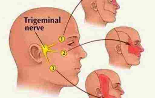 اعراض التهاب العصب الخامس وعلاجه