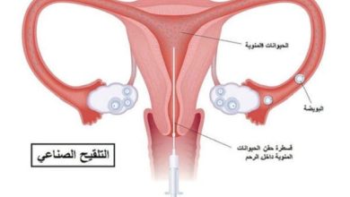 خطوات التلقيح الصناعي بالصور