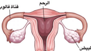 علاج انسداد الأنابيب بالاستغفار