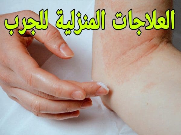 ما هي علامات الشفاء من الجرب الأكيدة